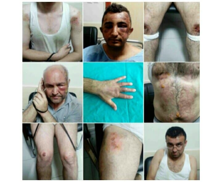 İşte Türkiye’de işkence gerçekleri : Saray’ın Danışmanı Kalın, ‘Cezaevlerini ve yargıyı işkenceden temizledik’ demişti