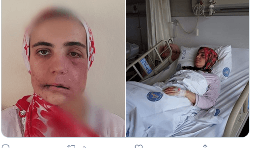 Kanser hastası Ayşe Özdoğan’ın feryadı: Çok çaresizim, sesime ses olun!