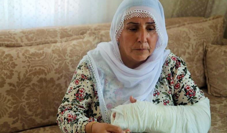 Diyarbakır’da kadınların kol ve dişini kıran polislere takipsizlik