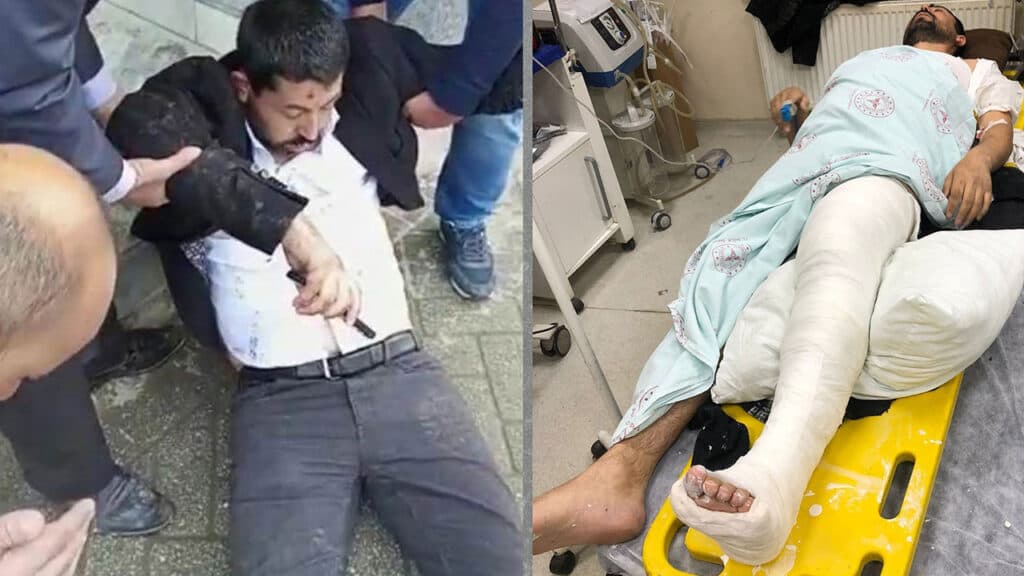 Milletvekili Habip Eksik: Polis, bilinçli olarak ayaklarımızı, bacaklarımızı kırmak için vurdular