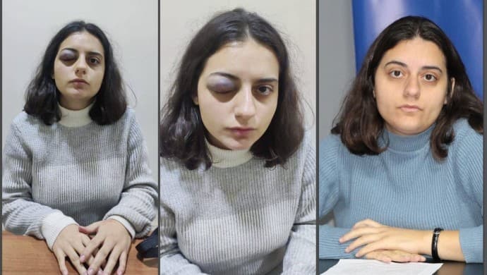 HEDEP’li İbrahimoğlu, polis şiddetini anlattı: Atkı ile boğmaya çalıştı, başımı araca vurdu