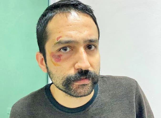 Saray’ın Yargıcı Gürlek ceza vermişti: Av.Aytaç Ünsal yatarını bitirmesine rağmen tahliye edilmiyor