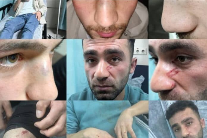 Hakkari’de vahşet: Sivil polis aracını sollayan 4 gence işkence ve darp