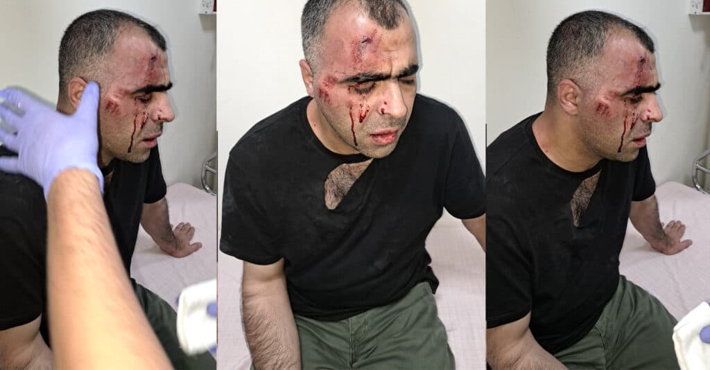 Gazeteci Sinan Aygül’ü linç eden AKP’li başkanın polis koruması görevden uzaklaştırıldı