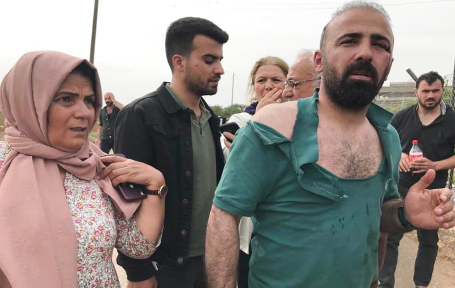Şanlıurfa’da YSP Milletvekili Ferit Şenyaşar’ın da aralarında olduğu heyete taşlı sopalı saldırı