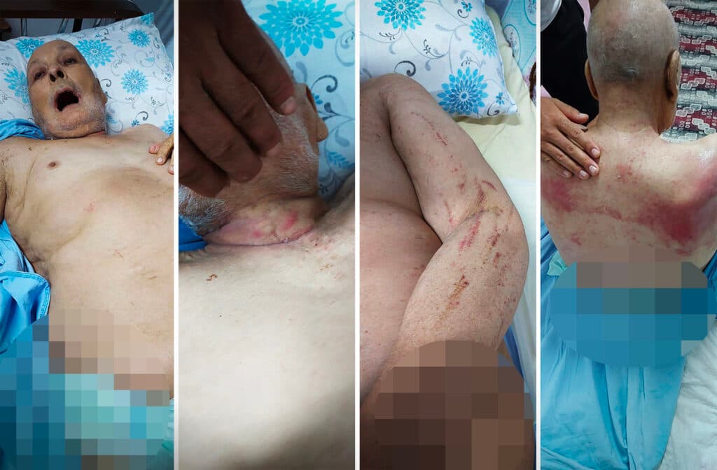 Cezaevinden evine yara bere içinde ve 20 kilo vererek döndü: Rejimin Yargısı, 86 yaşındaki Mustafa Said Türk’ü ne hale getirdi?