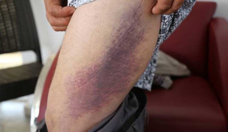 Yaylak Jandarma Karakolu’ndan Urfa TEM’e kadar süren işkenceyi anlattı