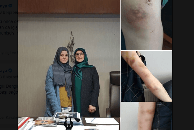 Acun Karadağ’ın evini giren polis dağıttı: Bakan Süleyman Soylu tarafından tehdit edilen, Merve Demirel’e gözaltında acımasızca işkence