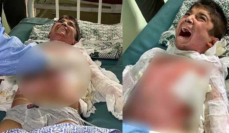 Kimyasal silahla yaralandığından şüphelenilen çocuğun tedavisi Erbil’de yapılacak