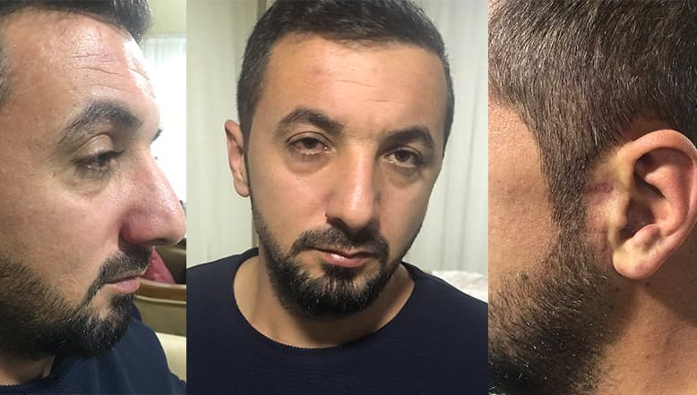 İzmir’de kaçırılan Adem Özdaman, eli yüzü kanlı şekilde evinin önüne bırakıldı