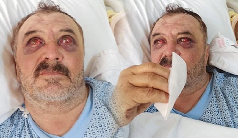 İşkence gören köylüler, tedavileri tamamlanmadan taburcu edilmeye çalışılıyor