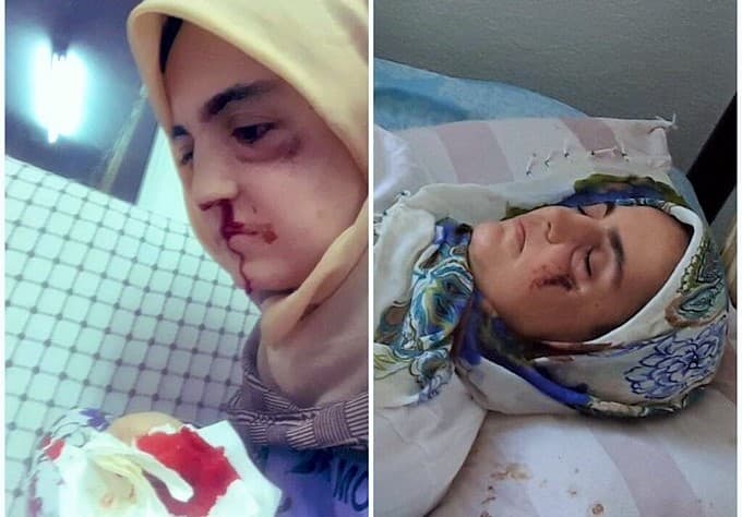 Ayşe Özdoğan raporunu inceleyen Mazlumder: Mahpusların ölümüne yol açan Adli Tıp lağvedilmeli