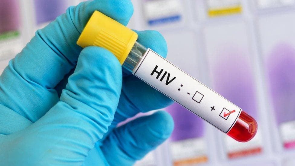 Avustralya bilim insanlarından, HIV tedavisinde tarihi adım: Virüs hücre içinde görünür hâle getirildi