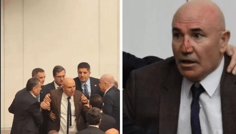 AKP’lilerin saldırısında burnu kırılan Mahmut Tanal hastaneye kaldırıldı