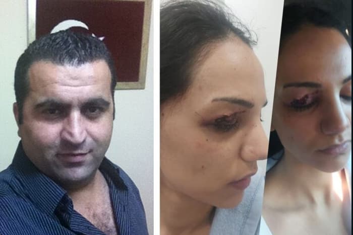 Emniyet müdürü dehşeti; meslektaşının eşine önce çıplak arama yaptırdı, sonra darp etti