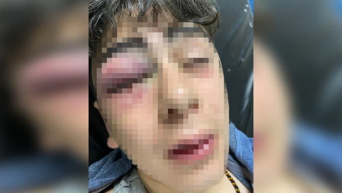 Diyarbakır’da işkence: ‘Polis, 14 yaşındaki çocuğu ölesiye dövüp dereye attı’