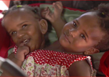 Yapışık ikiz babası: Bir çocuğumu hayatta tutmak için diğerinin ölümüne razı olamam