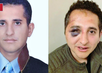 Cumhurbaşkanlığı korumalarının işkence yaptığı avukat ev hapsi nedeniyle hastaneye gidemiyor