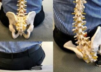 Uzmanlar uyarıyor: Arka cepte cüzdan taşımayın!