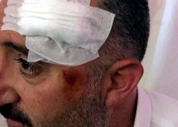 Konu Meclis’te: Ağrı’da polis, belediye başkanlarını ters kelepçeleyip copladı