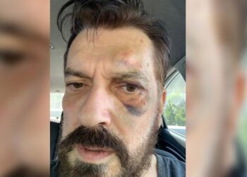 Bahçeli’nin Yardımcısı’nı sert eliştirmeşti: SONAR Araştırma şirketinin sahibi Hakan Bayrakçı’ya saldırı