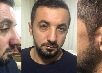 İzmir’de kaçırılan Adem Özdaman, eli yüzü kanlı şekilde evinin önüne bırakıldı