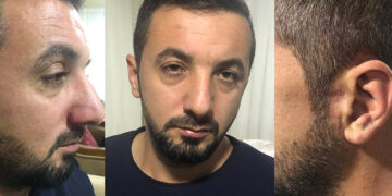İzmir’de kaçırılan Adem Özdaman, eli yüzü kanlı şekilde evinin önüne bırakıldı