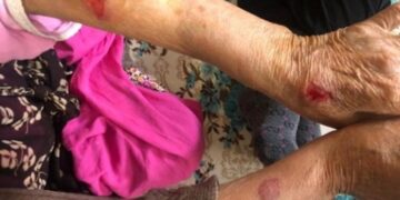 Polis, gözaltına aldığı HDP’li başkanın 90 yaşındaki annesini darp etti