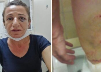 Müvekkilinin gözaltında işkence gördüğünü açıklayan avukat ifadeye çağrıldı