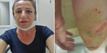 Müvekkilinin gözaltında işkence gördüğünü açıklayan avukat ifadeye çağrıldı