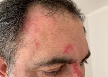 Gazeteci Abdullah Bozkurt’a İsveç’te saldırı