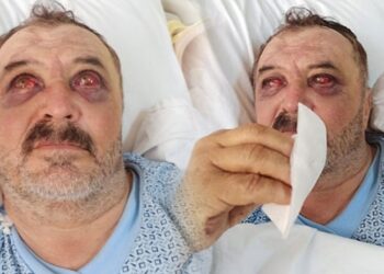 İşkence gören köylüler, tedavileri tamamlanmadan taburcu edilmeye çalışılıyor