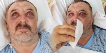 İşkence gören köylüler, tedavileri tamamlanmadan taburcu edilmeye çalışılıyor