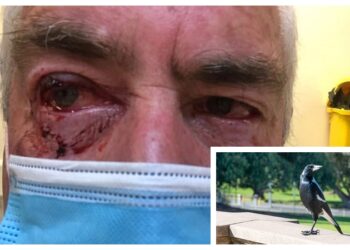 Victoria’da saksağanın saldırasıyla az kala gözlerinden olacaktı