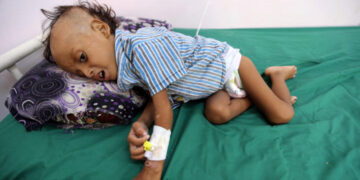 UNICEF Başkanı: Yemen’de 12 milyondan fazla çocuk insani yardıma muhtaç