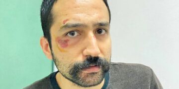 Av.Ünsal’ın babası oğluna Edirne’de yapılan işkenceye isyan etti: Yaşamak için nereye gidelim