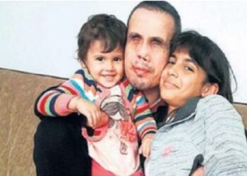 AKP yargısının hukuk cinneti: Bomba imha ederken iki gözünü ve elini kaybeden gazi polisi ‘terörist’ ilan etti ve hapse attı