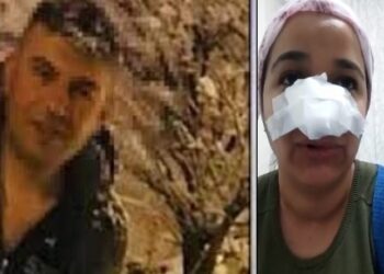 Bingöl’de uzman çavuş, bir kadını darp edip burnunu kırdı