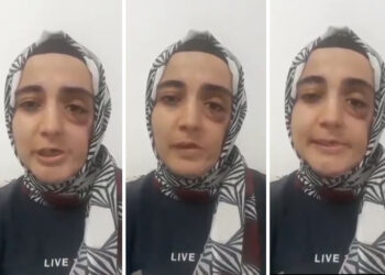 Ayşe Özdoğan’ın durumu kötüye gidiyor, yüzündeki platin yeniden çıkartılacak