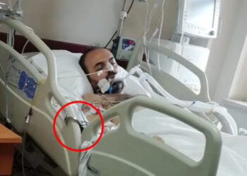 Skandalın ortaya çıktı: Entübe edilen KHK’lı polise 35 gün boyunca kelepçe