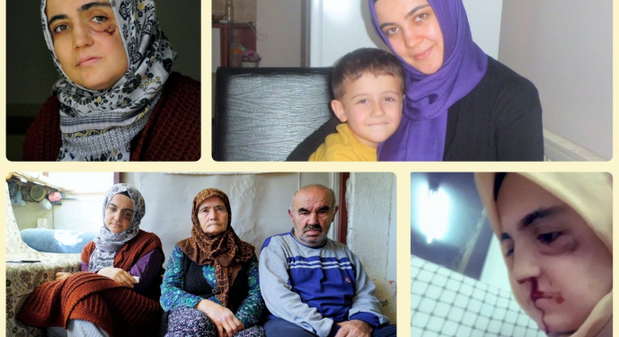 Ayşe Özdoğan’ın annesi: Dişleri yok kızımın, şırıngayla mama veriyorum