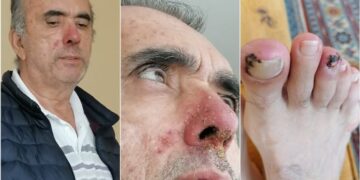 Adalet Bakanlığı nihayet duydu: Zeki Özkan’a ilaçları veriliyor, ceza tehiri işlemleri re’sen başlatıldı