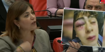 HDP Mvekili konuyu Meclis’e taşıdı: Diyarbakır’da çocuğa işkence yapan 5 polise uzaklaştırma