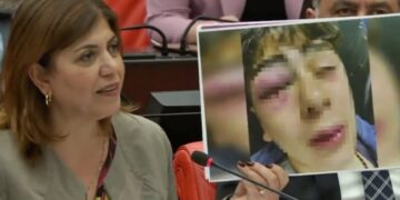 HDP Mvekili konuyu Meclis’e taşıdı: Diyarbakır’da çocuğa işkence yapan 5 polise uzaklaştırma