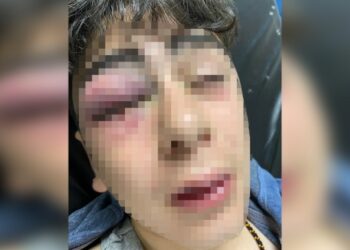 Diyarbakır’da işkence: ‘Polis, 14 yaşındaki çocuğu ölesiye dövüp dereye attı’