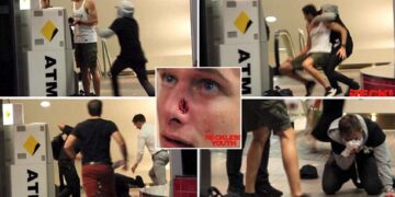 Sydney’de şaka yapmak isteyen YouTuber’ın burnu kırıldı