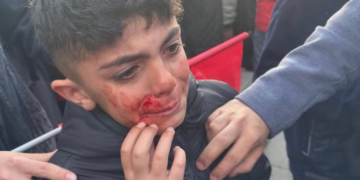 Erdoğan ve Cumhur ittifakı’nın eşkıyaları, Erzurum’daki saldırıda çocukları da yaraladılar