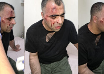Gazeteci Sinan Aygül’e saldıran iki koruma da gözaltında