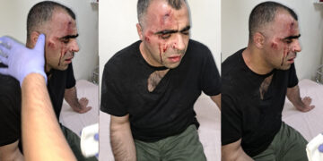 Gazeteci Sinan Aygül’ü linç eden AKP’li başkanın polis  koruması görevden uzaklaştırıldı