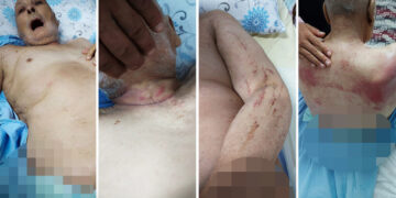 Cezaevinden evine yara bere içinde ve 20 kilo vererek döndü: Rejimin Yargısı, 86 yaşındaki Mustafa Said Türk’ü ne hale getirdi?